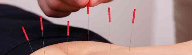 How to Heal with Acupuncture